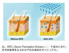 纳米微针多久做一次比较好?怎么护理? 纳米微针多久做一次比较好?怎么护理?