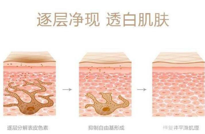 复合彩光祛斑要多久恢复?影响恢复时间的因素有哪些?