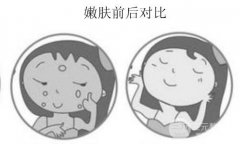 复合采光嫩肤果能够维持多久？是否持久？