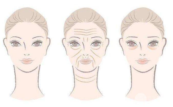 去鱼尾纹一般要多少钱呢?影响价格的因素有哪些?