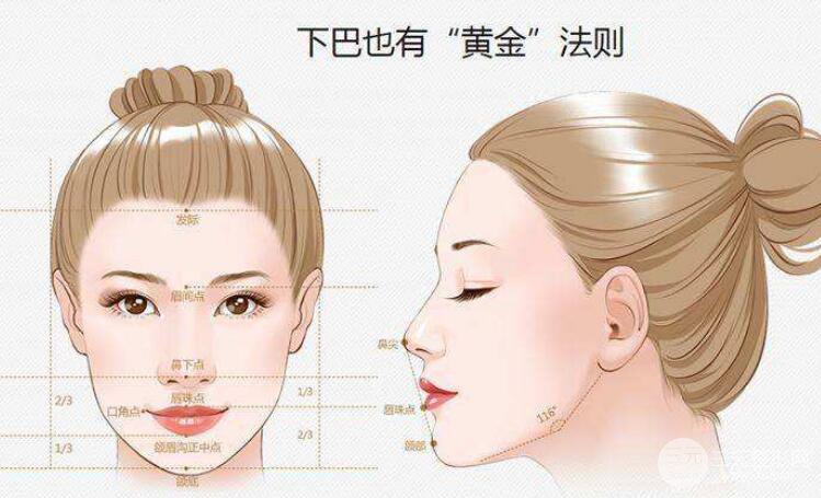 玻尿酸垫下巴维持多久?影响果维持时间的因素有哪些?