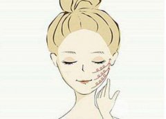 下颌角磨骨术恢复期有什么注意事项