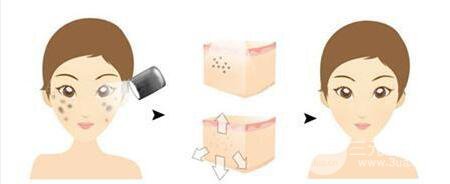 成都彩光嫩肤一般多少钱？整形改良果如何