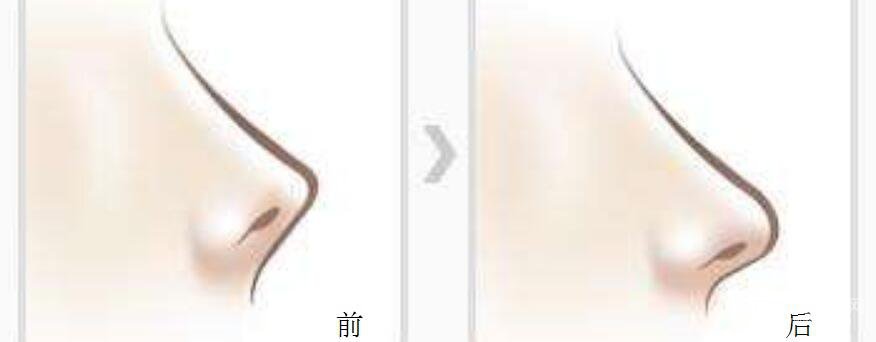 深圳人民医院整形价格贵吗?全新价格表一览