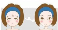 眉间纹怎么去除?去除方法有哪些? 眉间纹怎么去除?去除方法有哪些?