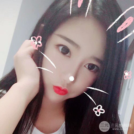 面部吸脂瘦脸
