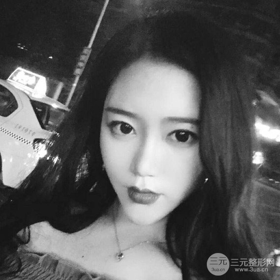 面部吸脂瘦脸