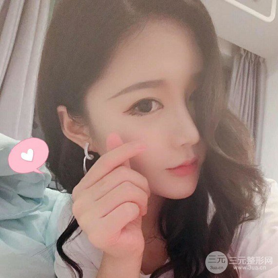 面部吸脂瘦脸