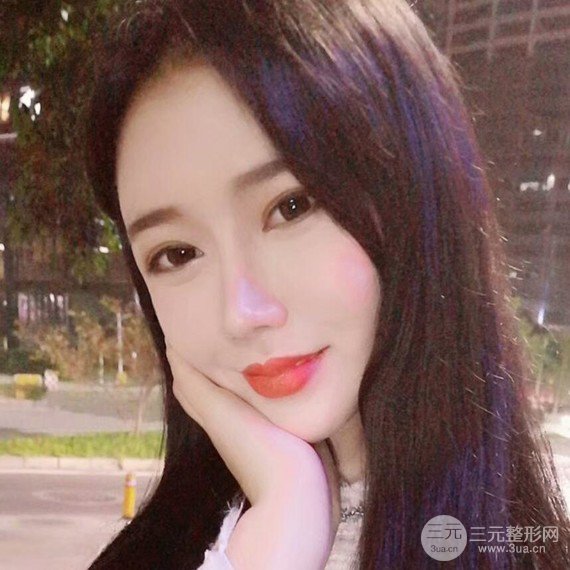 面部吸脂瘦脸