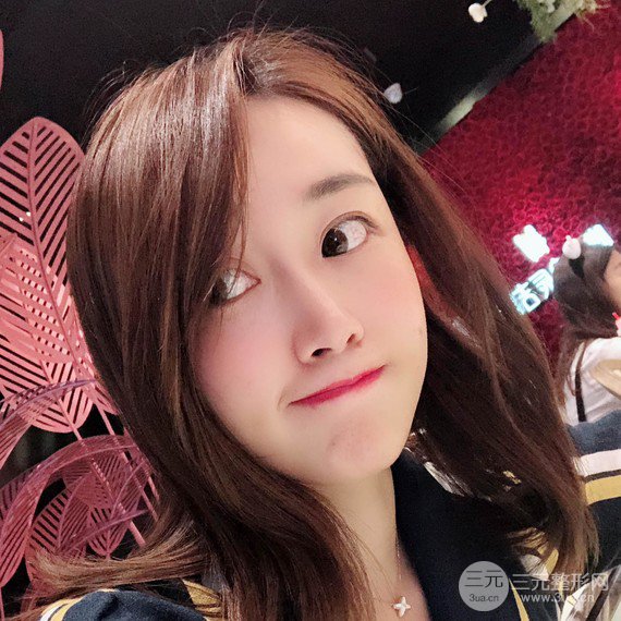 【术后3天即可上妆】大V.线 定点提拉 让脸“嘭嘭嘭”！