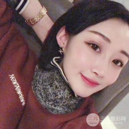 【术后3天即可上妆】大V.线 定点提拉 让脸“嘭嘭嘭”！