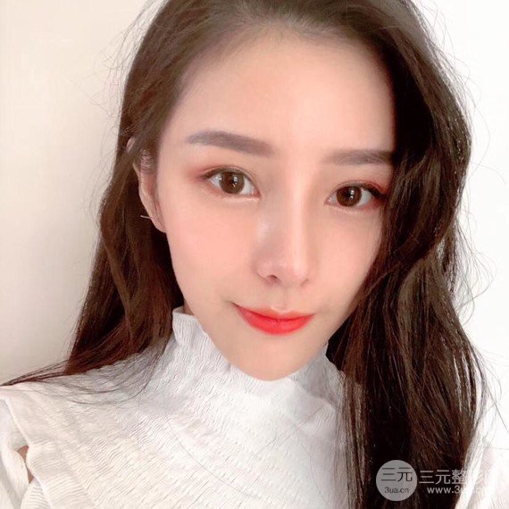 【隆鼻整形+进口假体+耳软骨垫鼻尖+鼻头鼻翼缩小+鼻尖延长】综合改良!