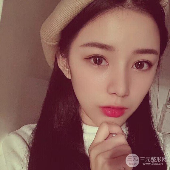 【隆鼻整形+进口假体+耳软骨垫鼻尖+鼻头鼻翼缩小+鼻尖延长】综合改良!