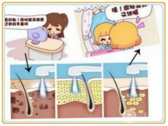 上海光子嫩肤一次要多少钱？价格影响有？