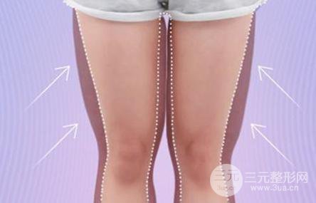 光纤溶脂瘦大腿一般要多少钱?影响价格因素是?