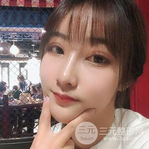 生物焊接双眼皮一个月的样子 真实果图对比 图片分享