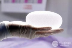 双平面立体隆胸优缺点有哪些