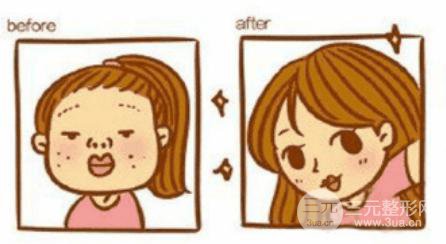 去皱纹针有副作用吗？副作用有哪些？