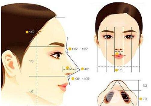 隆鼻假体取出有什么后遗症吗？