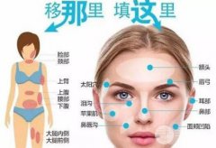 什么是活细胞填充?术后如何做好护理工作?