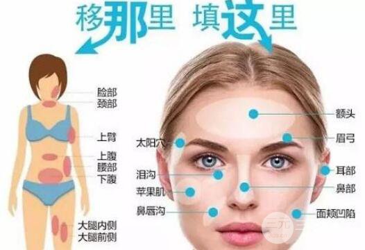 什么是活细胞填充?术后如何做好护理工作?