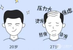 武汉缓解脱发价格贵不贵?影响价格的因素有哪些? 武汉缓解脱发价格贵不贵?影响价格的因素有哪些?