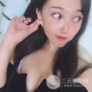 蜜桃假体隆胸