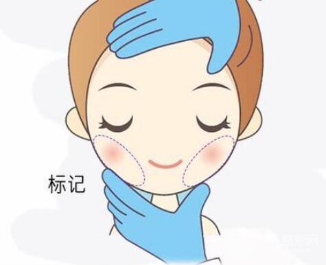 玻尿酸垫下巴多久消肿?需要注意什么?