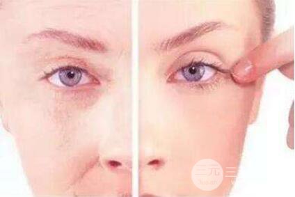 成都悬吊除皱术价格贵不贵?悬吊除皱价格贵吗?