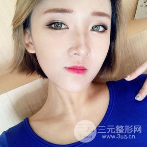 下巴注射