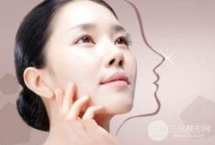鼻翼缩窄手术有后遗症吗?后遗症有哪些? 鼻翼缩窄手术有后遗症吗?后遗症有哪些?