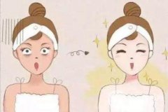 光学嫩肤的原理是什么？术后有何注意事项？