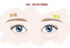 卧蚕塑造方法有几种?术后如何护理? 卧蚕塑造方法有几种?术后如何护理?