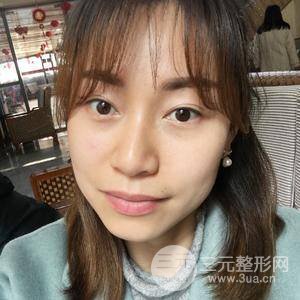 除眼袋手术