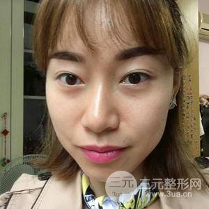除眼袋手术