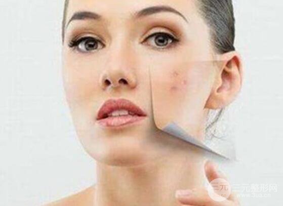 点阵激光去痘坑会反弹吗