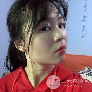 眼部吸脂