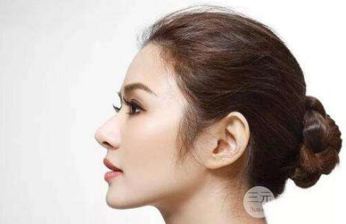 成都自体耳软骨隆鼻果怎么样?果好不好？