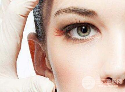 成都自体脂肪去鱼尾纹贵不贵?影响因素有哪些?