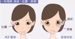 成都祛眼袋费用大概要花多少钱