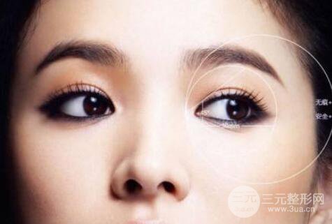 成都全切双眼皮果?全切双眼皮果怎么样?