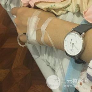 吸脂瘦大腿