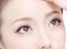 成都开眼角手术一般要多少钱?价格浮动大不大?