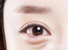成都去眼袋整形价格一般是多少?