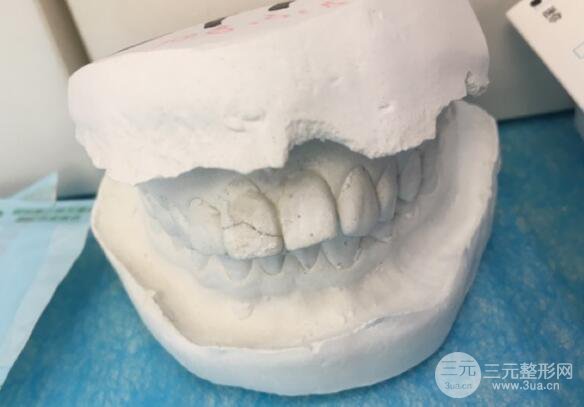 成都高新圣贝口腔怎么样\托槽矫正牙齿果反馈