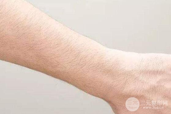 成都做激光脱毛手术费用一般在什么价位?