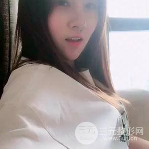 埋线双眼皮