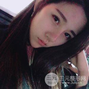 埋线双眼皮