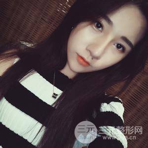埋线双眼皮