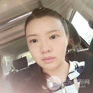 韩式微创除皱
